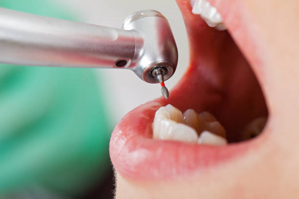 Best Knocked-Out Tooth Emergency  in Strasburg, VA